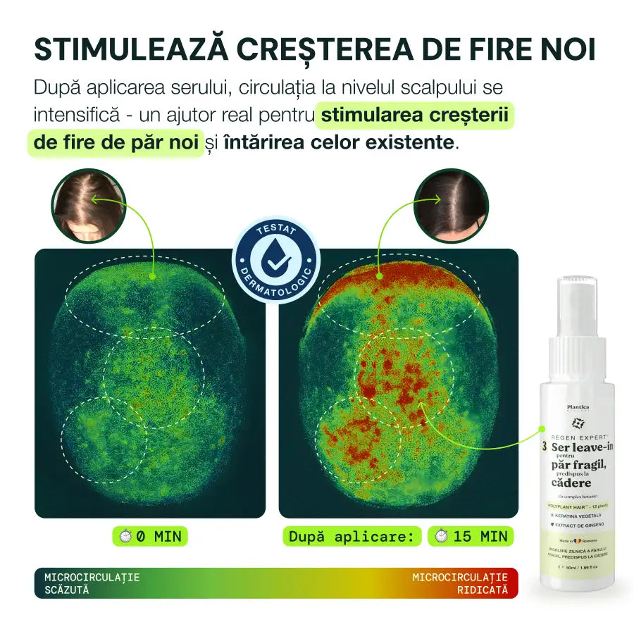 Set Regen Expert Femei – Reduce căderea, susține creșterea