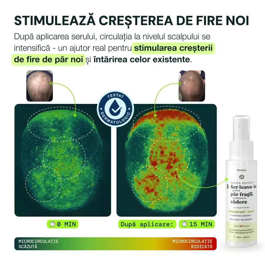 Set Regen Expert Bărbați - Reduce Căderea, Susține Creșterea