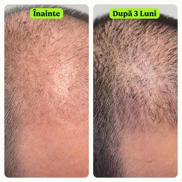 Clinical study results