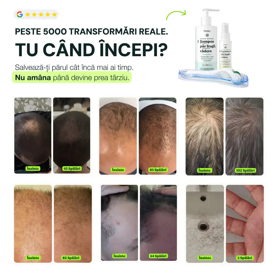 Set Regen Expert Bărbați - Reduce Căderea, Susține Creșterea