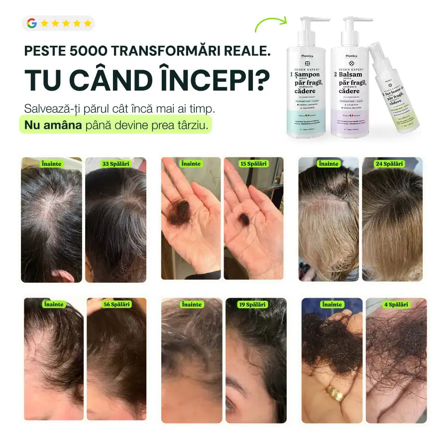Set Regen Expert Femei – Reduce căderea, susține creșterea