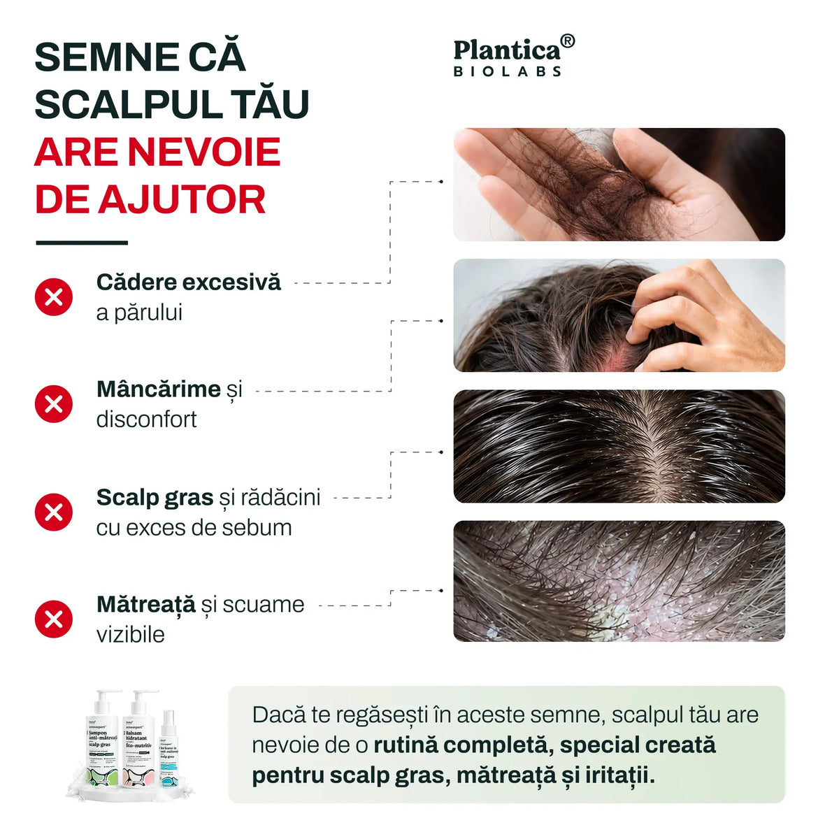 Set Derm Expert – Anti-mătreață și control sebum, pentru scalp gras
