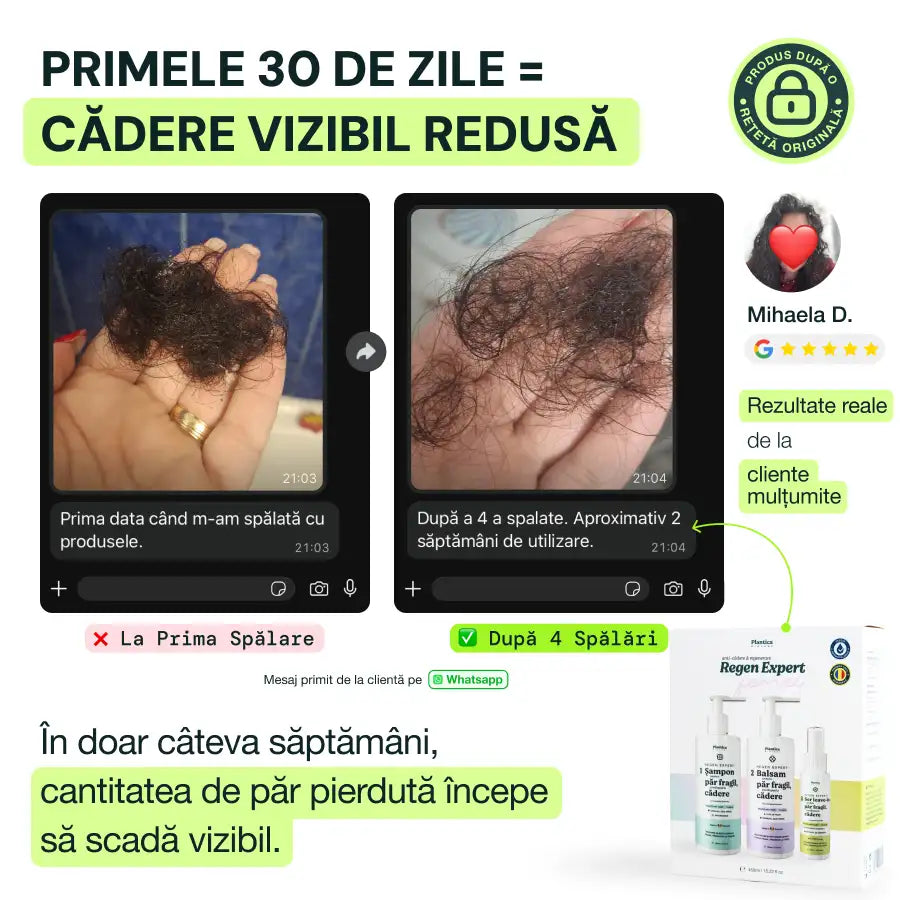 Set Regen Expert Femei - Stopează Căderea, Stimulează Creșterea