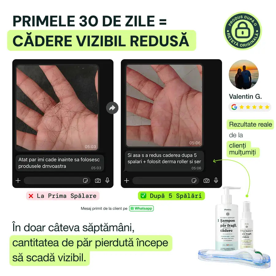 Set Regen Expert Bărbați - Stopează Căderea, Stimulează Creșterea