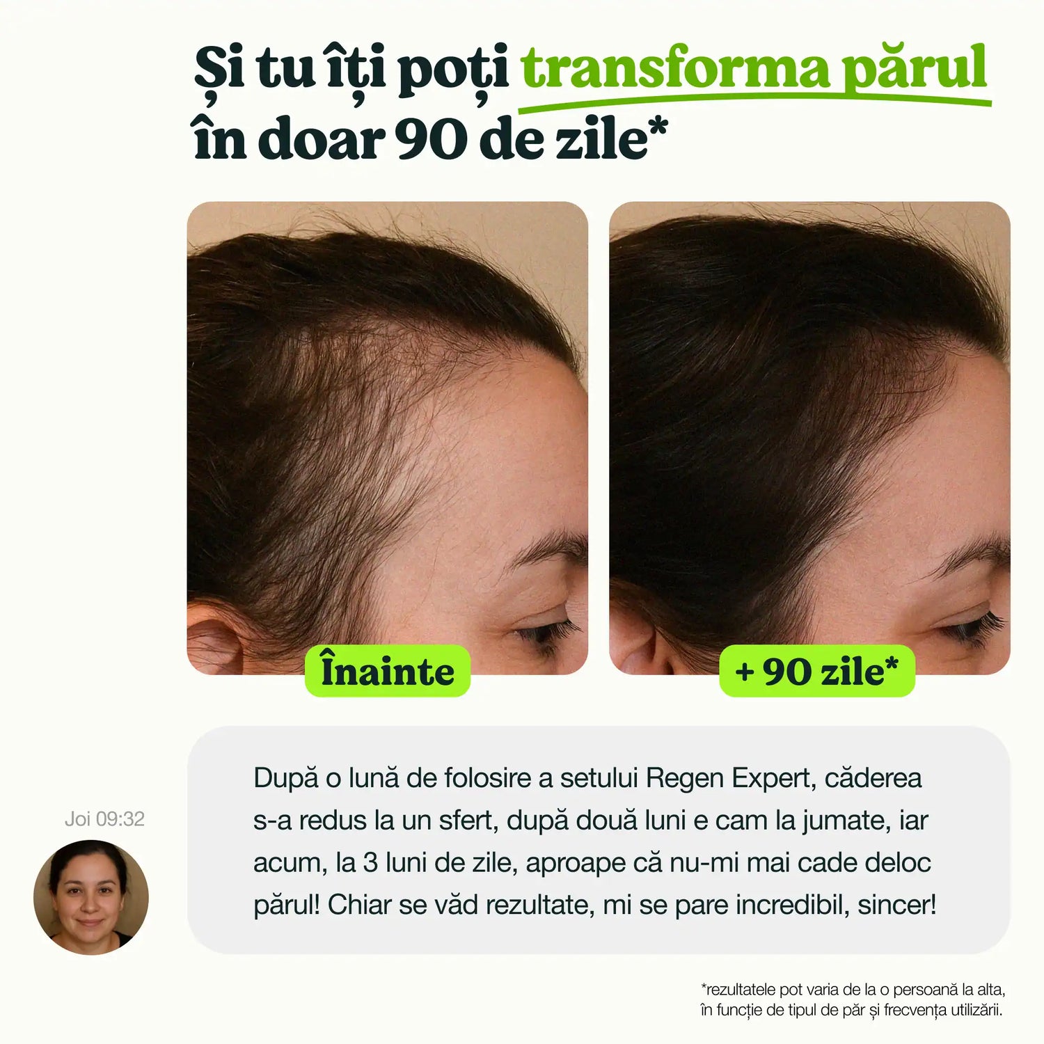 Rezultate înainte și după 90 de zile de folosire a setului Regen Expert pentru căderea părului, cu rezultate vizibile.
