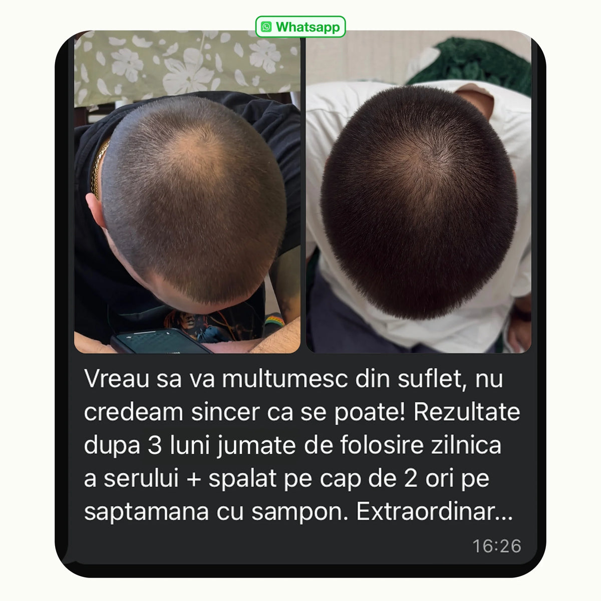 Rezultatele clienților înainte și după tratamentul pentru căderea părului – regenerarea părului după 3 luni de utilizare.