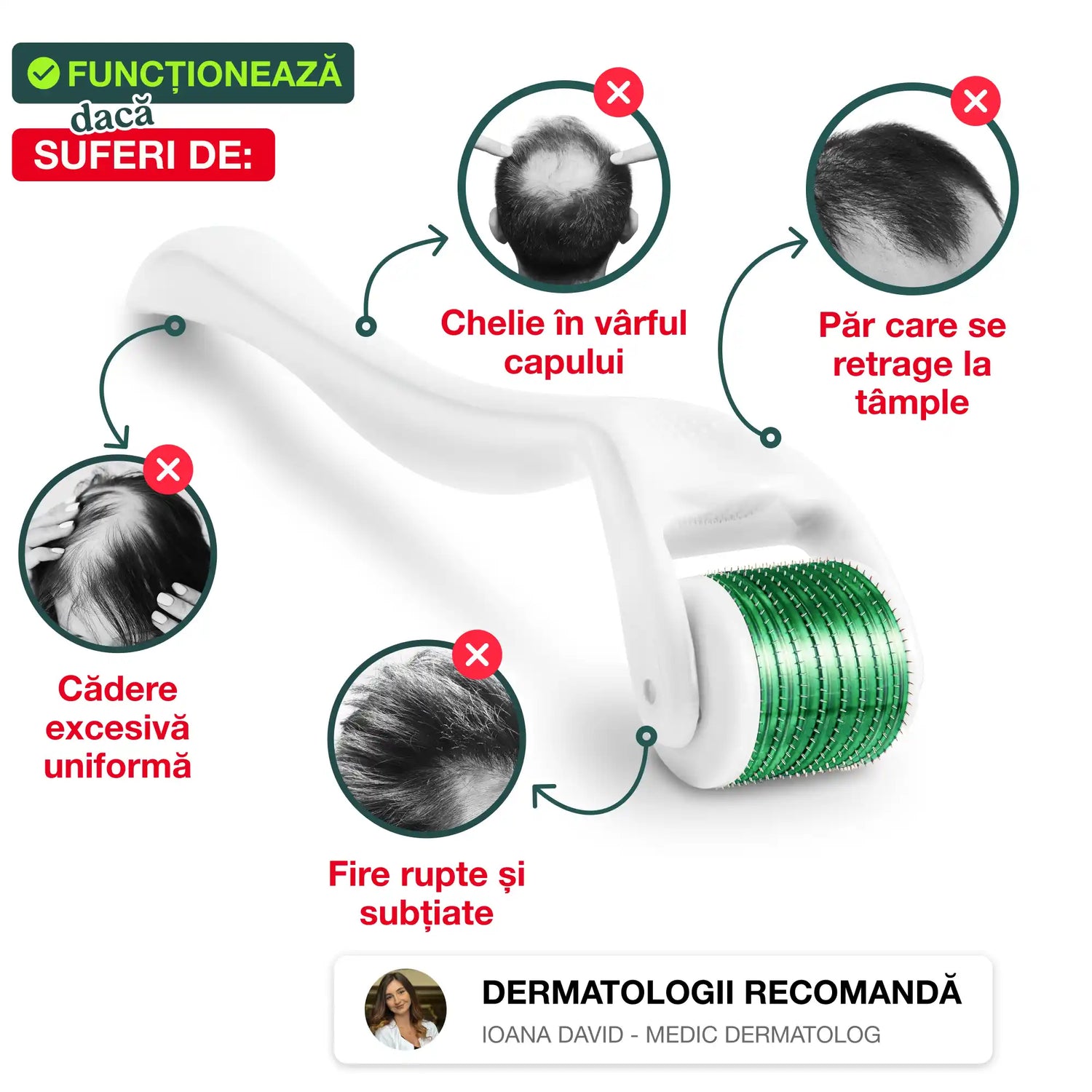 Derma Roller, Împotriva Căderii Părului, 540 ace din Otel Inoxidabil, 0.5 mm