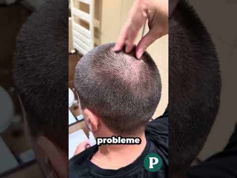 Set Regen Expert Bărbați - Reduce Căderea, Susține Creșterea